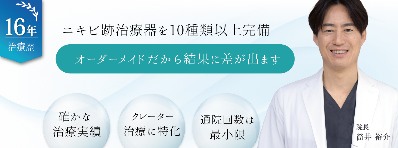 ニキビ跡の根本解決目指しませんか？