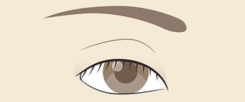 上瞼の凹みが目立つ、くぼみ型