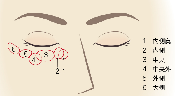 目の下の脱脂術の対象箇所