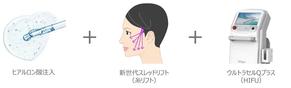 ほうれい線・顔のたるみ治療 おすすめプラン | セオリークリニック