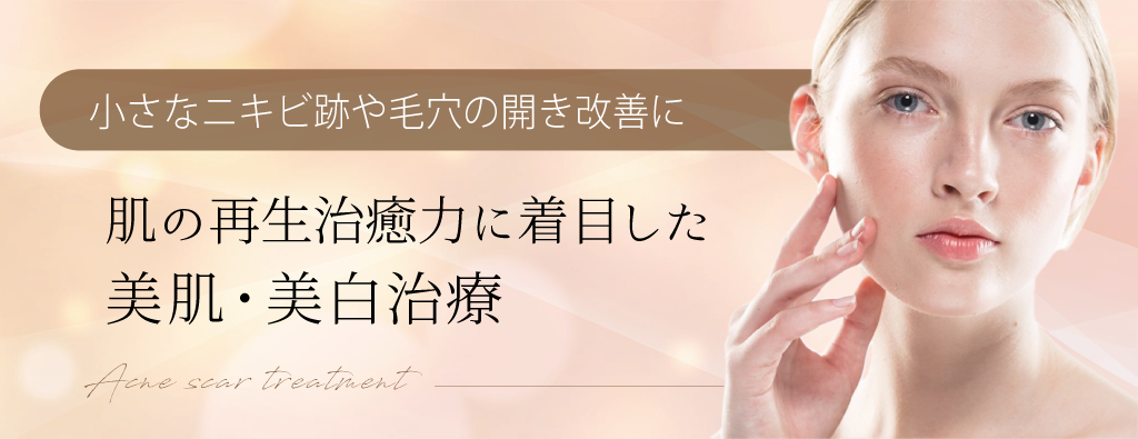 ダーマペンによるニキビ跡・毛穴治療 | セオリークリニック- 東京・銀座の美容外科・美容皮膚科