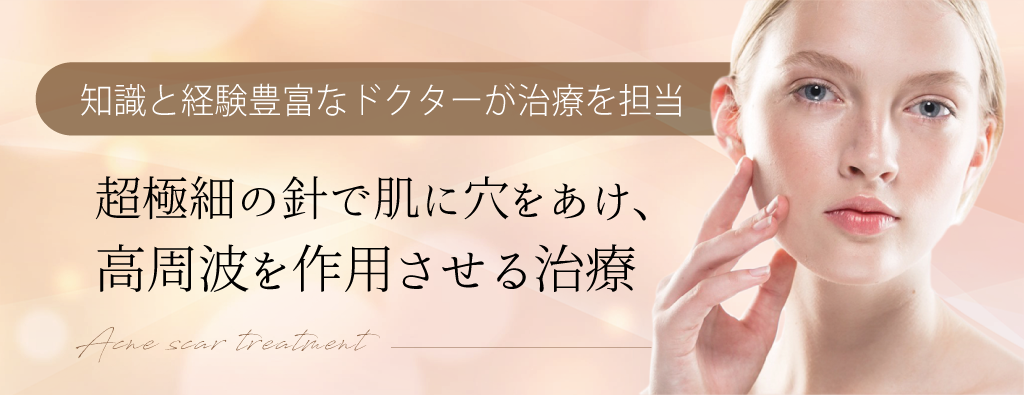 実践アトラス 美容外科注入治療 改訂第2版 | 征矢野 進一 |本