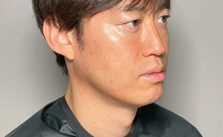 スレッドリフトのセオリー【裁断済み】 裁断済 スレッドリフトのセオリー スレッドリフトのセオリー