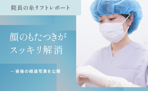 糸リフト（新世代スレッドリフト）によるほうれい線治療