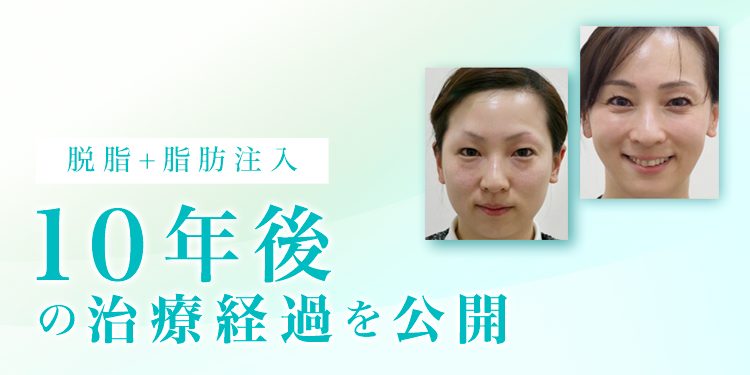 脱脂+脂肪注入から10年後の治療経過を公開