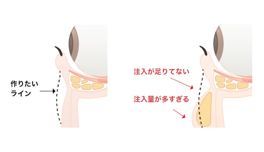 表情の変化に対応したデザイン