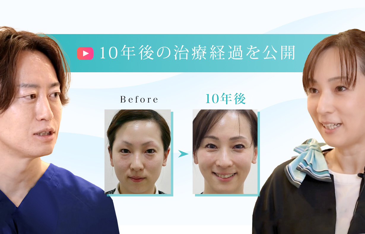 脱脂+脂肪注入 10年後の治療経過を公開