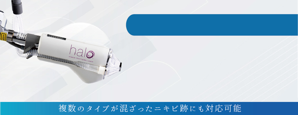 サイトンヘイロー