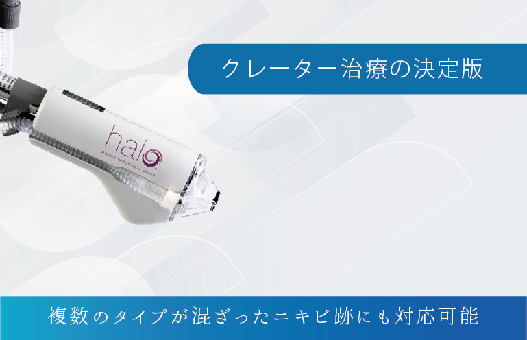 サイトンヘイロー