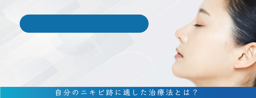 鼻のニキビ跡治療