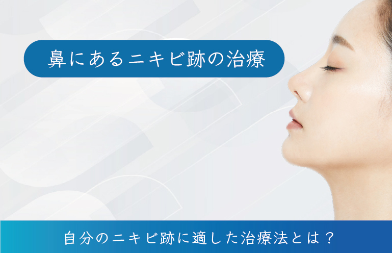 鼻のニキビ跡治療