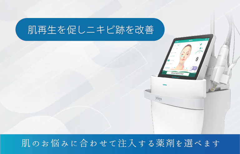 ポテンツァ
