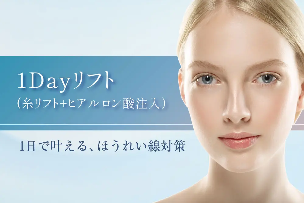 糸リフト（新世代スレッドリフト）によるほうれい線治療 | セオリー