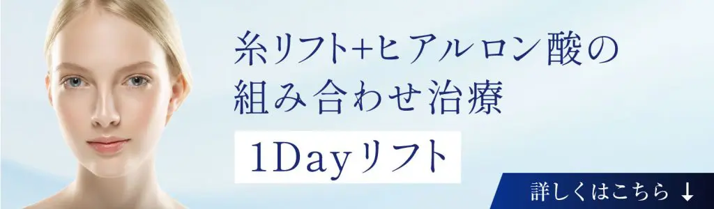 糸リフト（新世代スレッドリフト）によるほうれい線治療 | セオリー